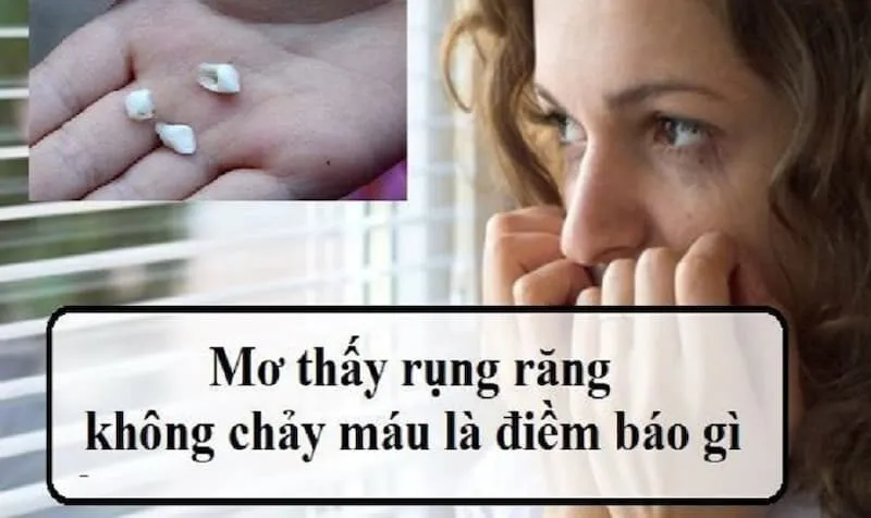 Nằm mơ thấy rụng răng hàm dưới là may hay rủi?