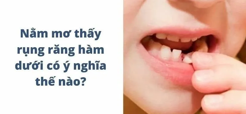 Nằm Mơ Thấy Rụng Răng Hàm Dưới Ý Nghĩa Gì & Đánh Số Mấy?